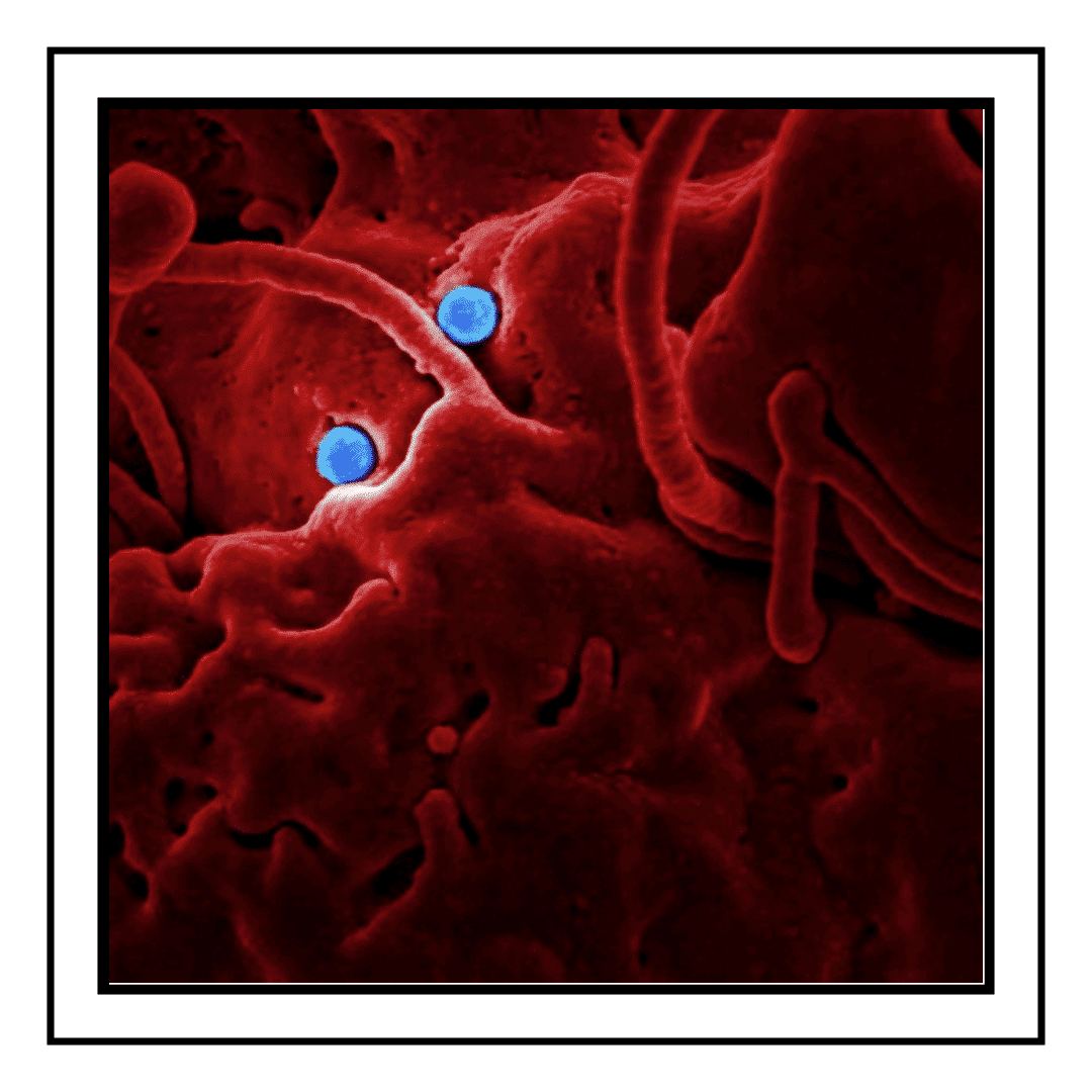 Virus